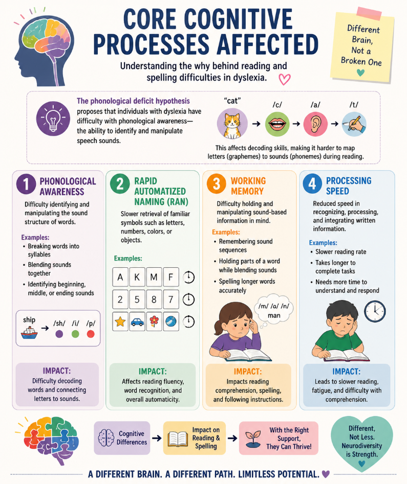 Dyslexia Brain Illustration